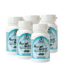 AcnEase Severe Acne Treatment - 5 Bottles