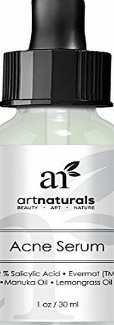Art Naturals Anti Acne Serum Treatment 1 oz- Dermatologist Tested Product, Made with Organic Ingredients to Help Control amp; Get Rid of Acne - Best Pore Minimizer -For all Ages by ArtNaturals