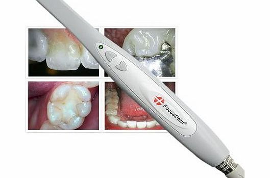 FocusDent Dental Intraoral Camera - High Quality, user-friendly Digital Video Imaging System for intra oral dental Photography - FocusDent MD740 - Slim Design, Crystal Clear Images, Easy USB Connection, 6 LED, 
