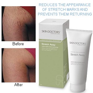 Stretch Away Stretch Mark Reduction Cream (200ml)