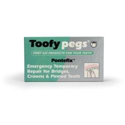 Pegs Pontefix Repair For Crowns and Pinned